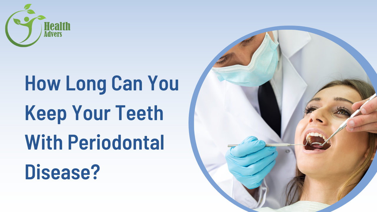 How Long Can You Keep Your Teeth With Periodontal Disease?