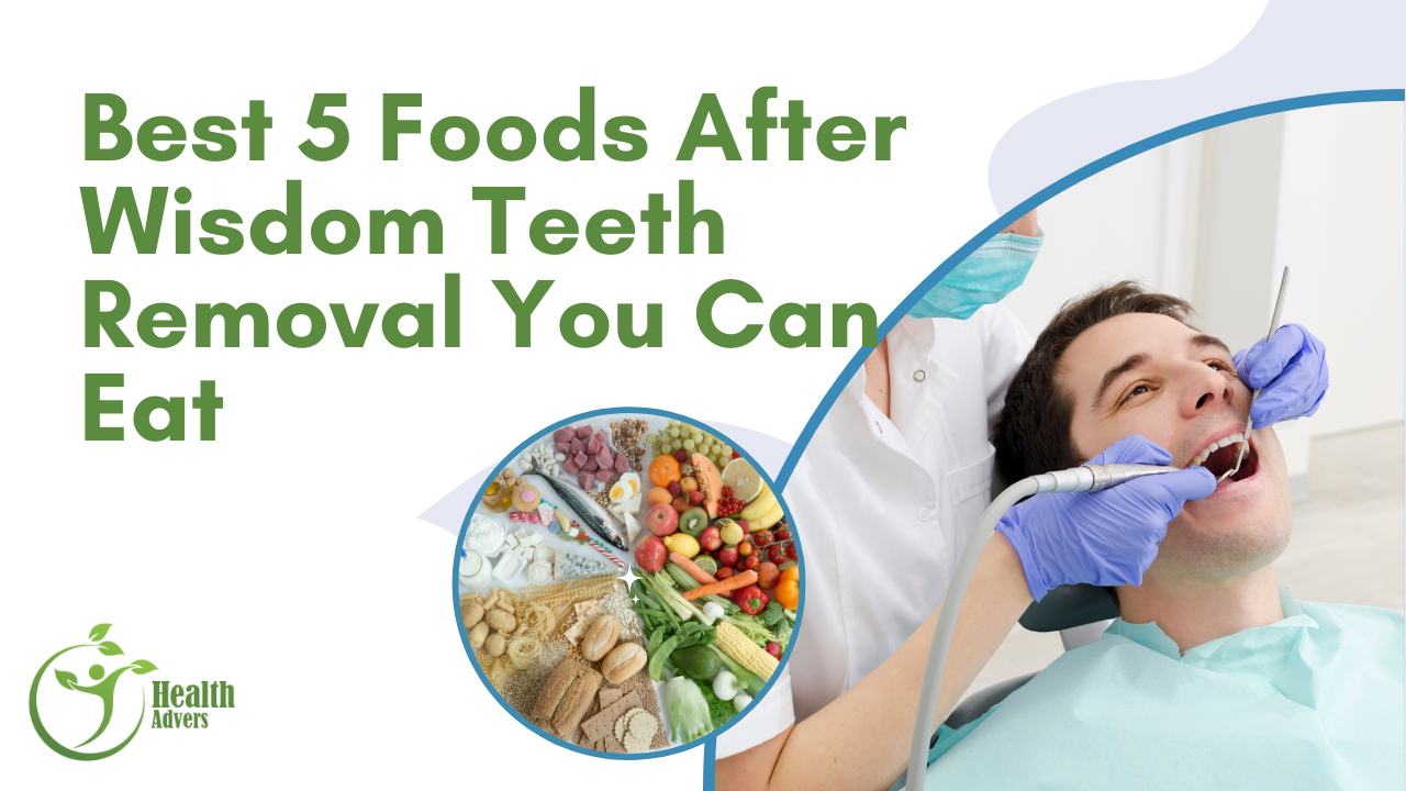 Best 5 Foods After Wisdom Teeth Removal You Can Eat