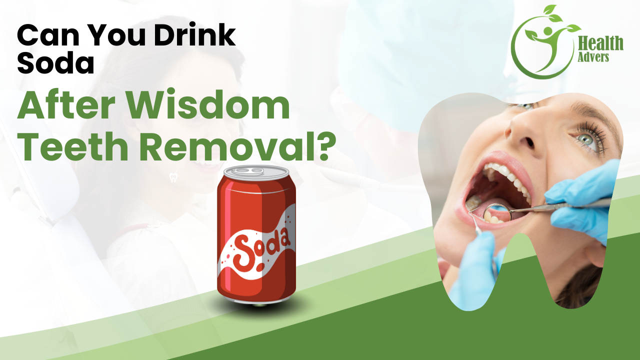 Can You Drink Soda After Wisdom Teeth Removal?